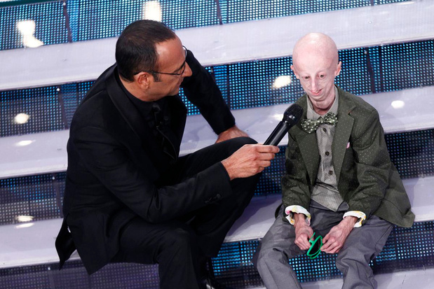 Mort à 28 ans du malade le plus âgé au monde atteint de vieillissement prématuré