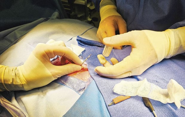 Un pacemaker pour les plus petits 