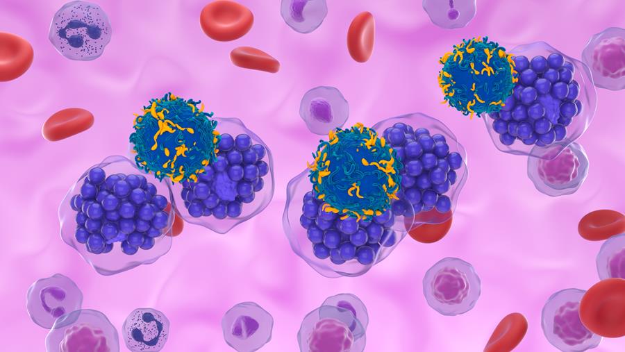 B-cellymfoom: fungusinfecties na behandeling met anti-CD19-CAR-T-cellen