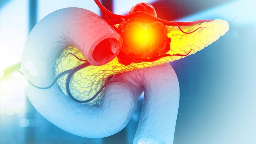 ASCO 2026: aanwinsten inzake lever- en pancreaskanker