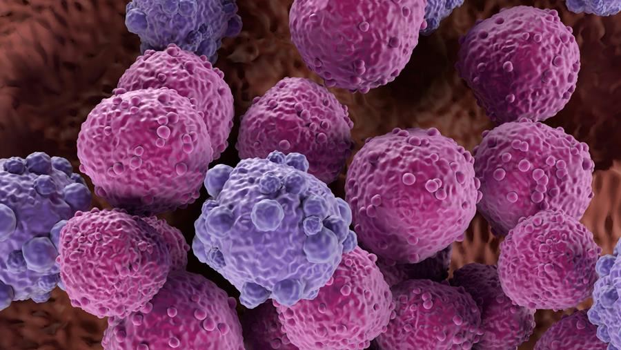 Grootcellig B-cellymfoom: combinatie van immunotherapie en R-CHOP remt tumorprogressie af