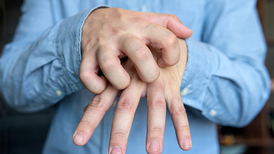 Schurft in Vlaanderen lijkt na jarenlange stijging te stabiliseren