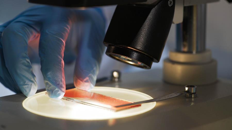VUB ontwikkelt veelbelovende nieuwe gentherapie voor hemofilie B