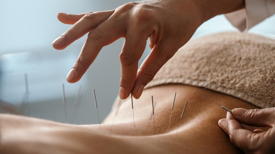 Acupuncturisten vragen Grondwettelijk Hof de opheffing van wet niet-conventionele praktijken te vernietigen